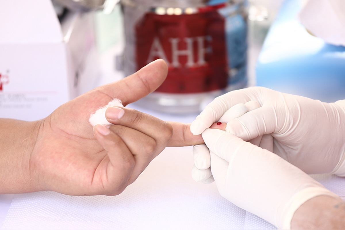 Pandemia de Covid-19 redujo en 55% detección de casos de VIH en población peruana, alerta AHF