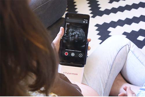 GE Healthcare invierte en Pulsenmore para desarrollar un tele-ultrasonido portátil y aumentar la tranquilidad de las futuras madres