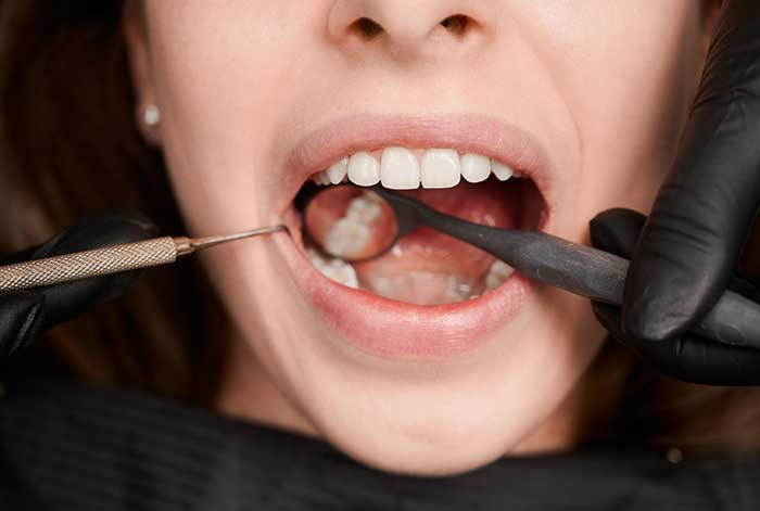 La importancia de la higiene bucal en personas con diabetes