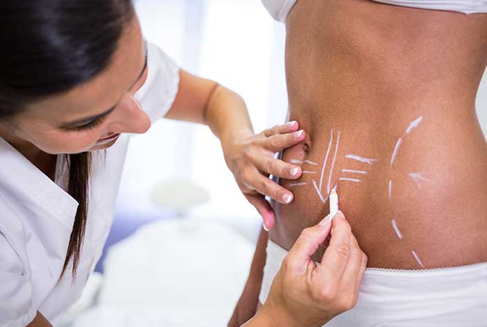 Prepárate para el verano: Elimina la grasa localizada y reafirma tu cuerpo con naturalidad y armonía