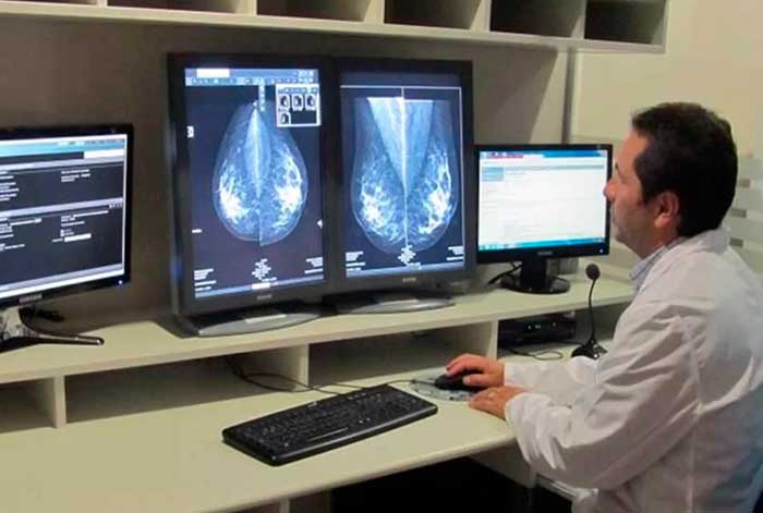 Peruanas esperan entre 6 y 9 meses para recibir un diagnóstico de cáncer de mama