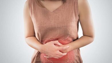Día de la Prevención del Cáncer de Colon: Conoce todo sobre esta enfermedad y cómo prevenirla
