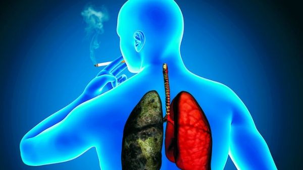 Día Mundial de la Salud: 3 consejos para prevenir el Cáncer al Pulmón