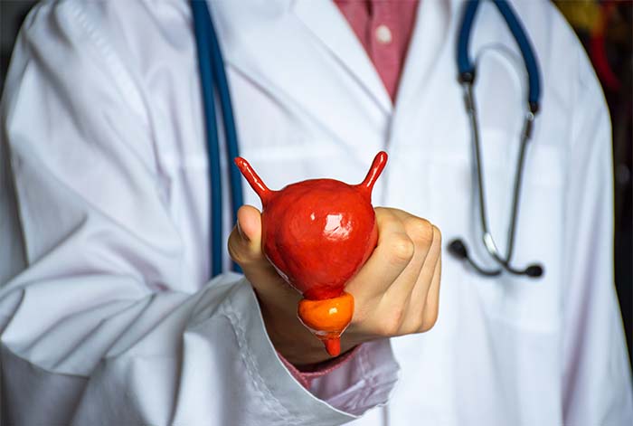 Día Internacional del Cáncer de Próstata: Hábitos que reducen el riesgo de desarrollar esta enfermedad