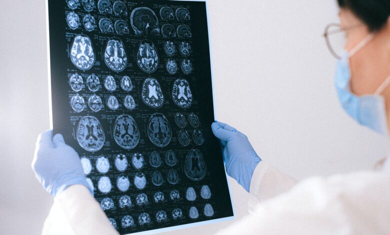 Sigue estos 3 consejos para mejorar la función cerebral