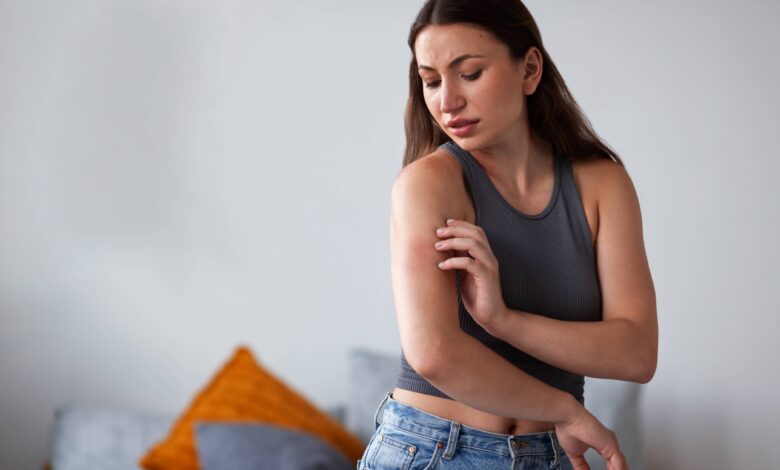 Semana Santa: Cinco recomendaciones para prevenir el dengue durante el feriado largo