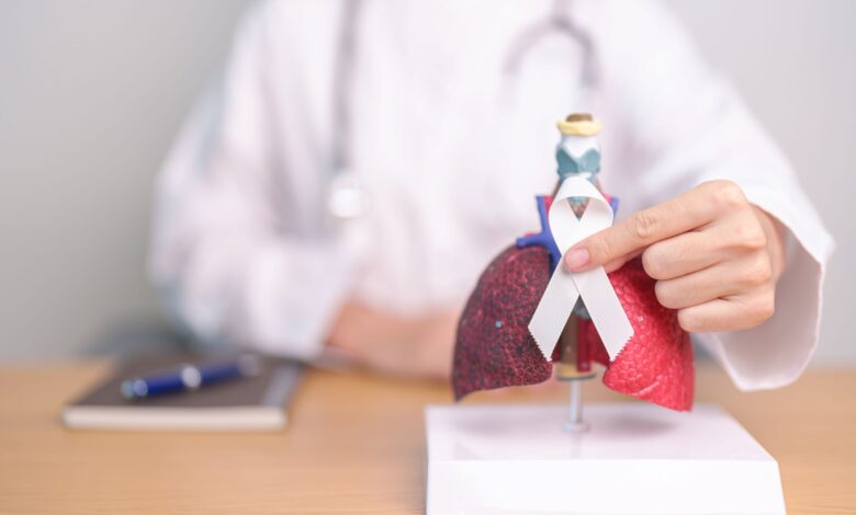 Cáncer de pulmón cada vez es más común en adultos jóvenes