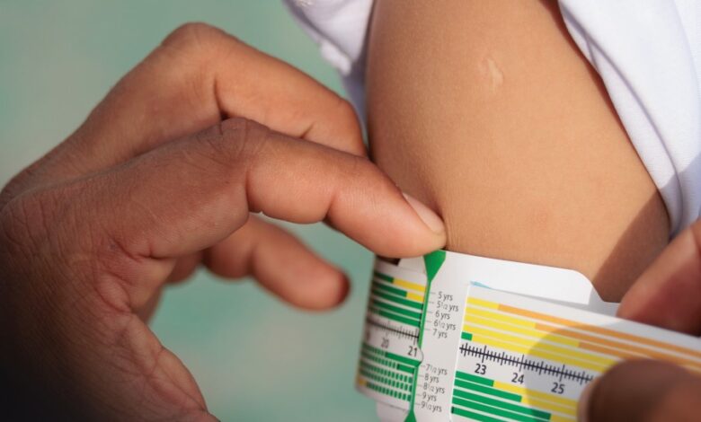 Malnutrición infantil en Perú: Más de 1 millón de niños en riesgo para 2030
