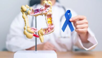 Cáncer de colon: señales de alerta y hábitos clave para prevenirlo a tiempo