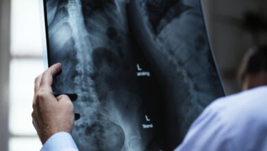 ¿Recibes más radiación en un avión o en una radiografía?
