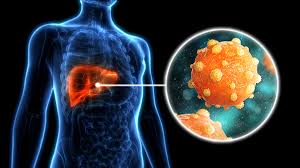 La hepatitis sigue cobrando más de un millón de vidas al año pese a los avances en prevención y diagnóstico1