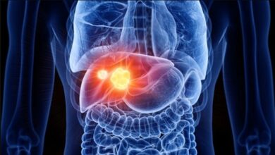 La hepatitis B: el virus silencioso que puede causar cáncer de hígado