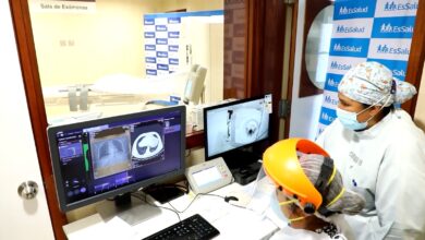 Nódulo pulmonar: qué es, cómo se detecta y en qué casos se requiere cirugía